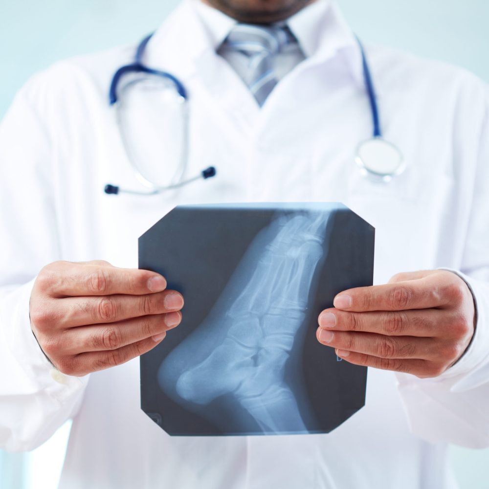 Close-up of doctor holding x-ray of human foot