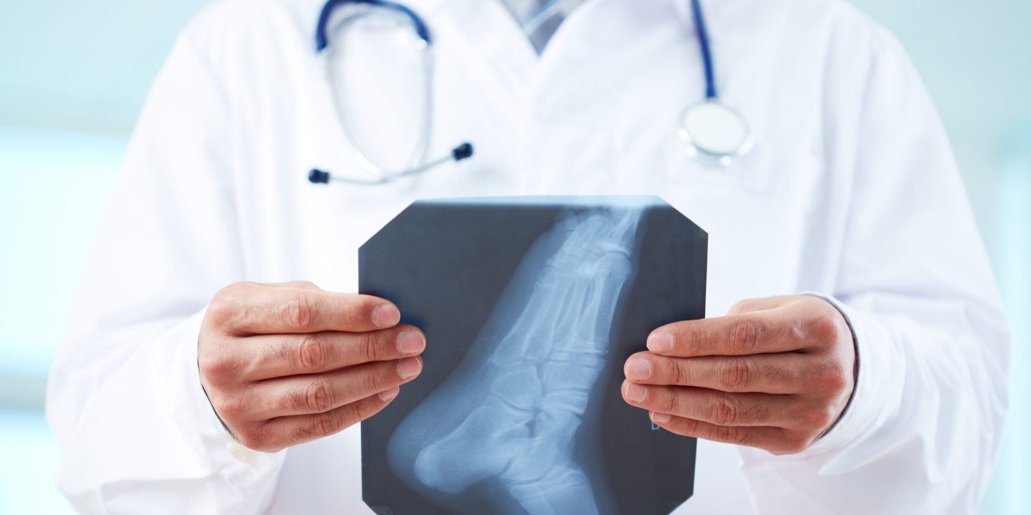 Close-up of doctor holding x-ray of human foot